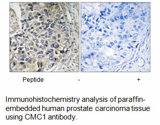 Product image for CMC1 Antibody