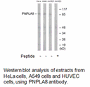 Product image for PNPLA8 Antibody