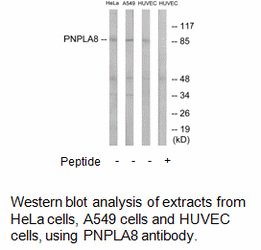 Product image for PNPLA8 Antibody