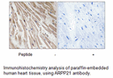 Product image for ARPP21 Antibody