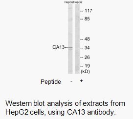 Product image for CA13 Antibody