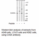 Product image for CA5A Antibody