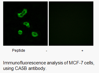 Product image for CA5B Antibody