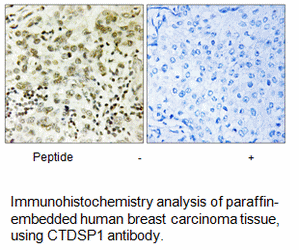 Product image for CTDSP1 Antibody