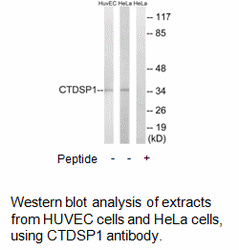 Product image for CTDSP1 Antibody