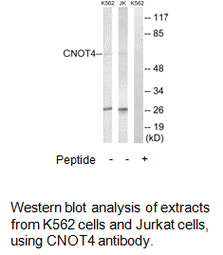 Product image for CNOT4 Antibody