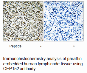 Product image for CEP152 Antibody