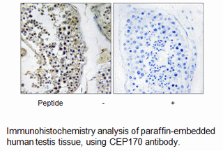 Product image for CEP170 Antibody