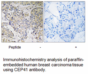 Product image for CEP41 Antibody