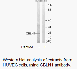 Product image for CBLN1 Antibody