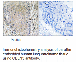 Product image for CBLN3 Antibody