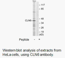 Product image for CLN6 Antibody