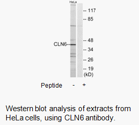 Product image for CLN6 Antibody