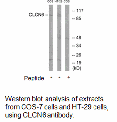 Product image for CLCN6 Antibody