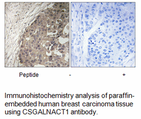 Product image for CSGALNACT1 Antibody