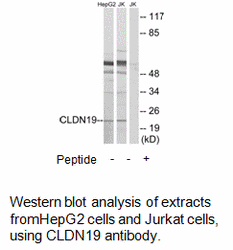 Product image for CLDN19 Antibody