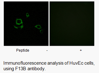 Product image for F13B Antibody
