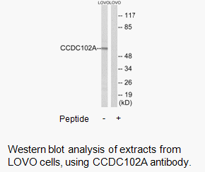 Product image for CCDC102A Antibody