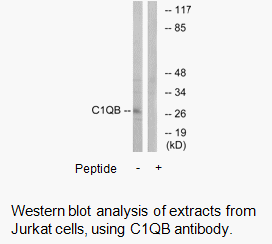Product image for C1QB Antibody