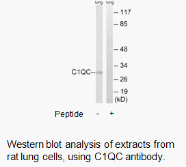 Product image for C1QC Antibody