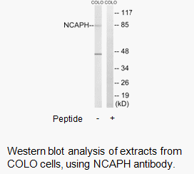 Product image for NCAPH Antibody