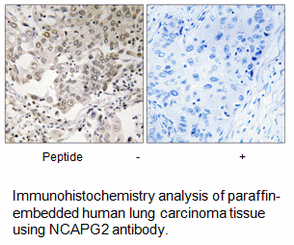 Product image for NCAPG2 Antibody