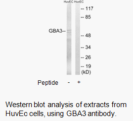 Product image for GBA3 Antibody