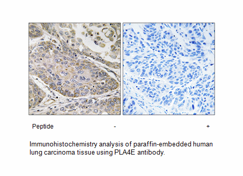 Product image for PLA2G4E Antibody