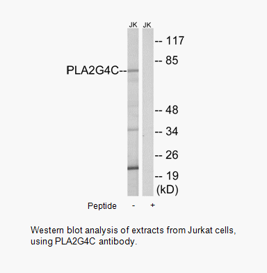 Product image for PLA2G4C Antibody