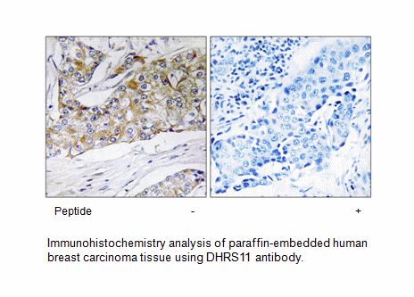 Product image for DHRS11 Antibody