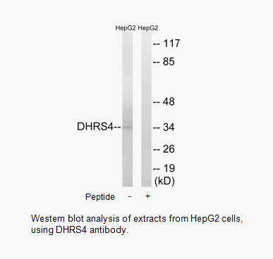 Product image for DHRS4 Antibody