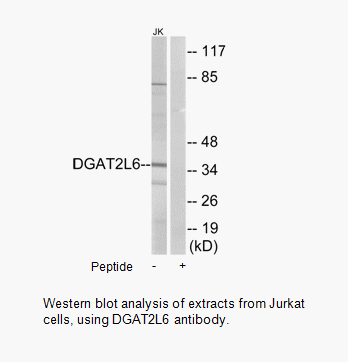 Product image for DGAT2L6 Antibody