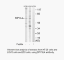 Product image for DPYSL4 Antibody