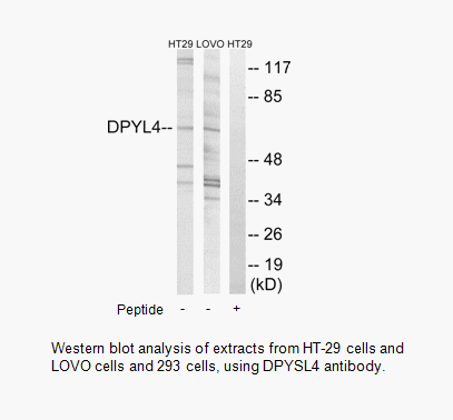 Product image for DPYSL4 Antibody