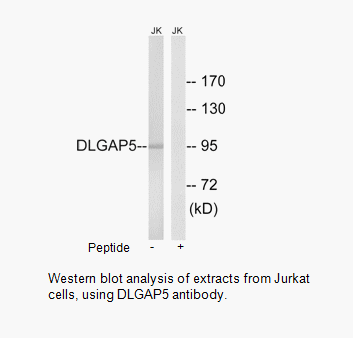 Product image for DLGAP5 Antibody
