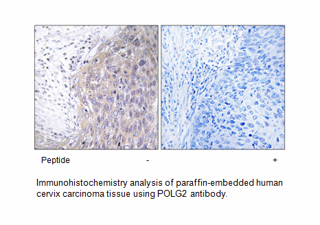 Product image for POLG2 Antibody