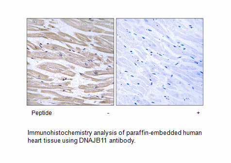 Product image for DNAJB11 Antibody