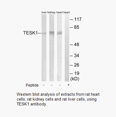 Product image for TESK1 Antibody