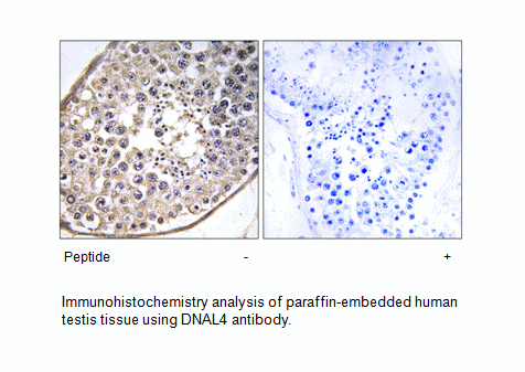Product image for DNAL4 Antibody