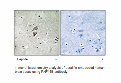 Product image for RNF149 Antibody