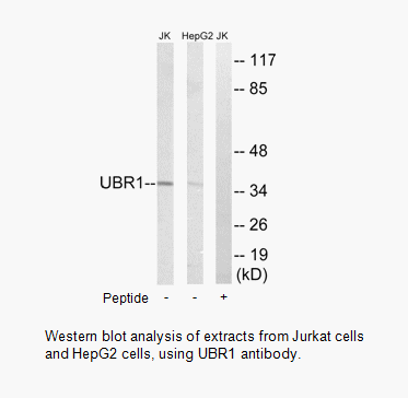 Product image for UBR1 Antibody