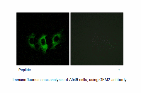 Product image for GFM2 Antibody