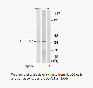 Product image for ELOVL1 Antibody