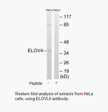 Product image for ELOVL4 Antibody