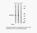 Product image for ALDOB Antibody