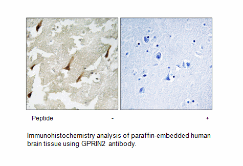 Product image for GPRIN2 Antibody