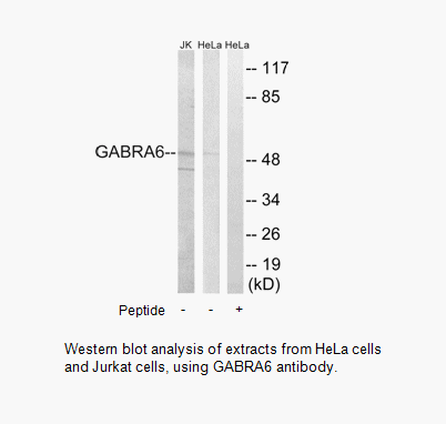 Product image for GABRA6 Antibody