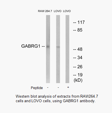 Product image for GABRG1 Antibody