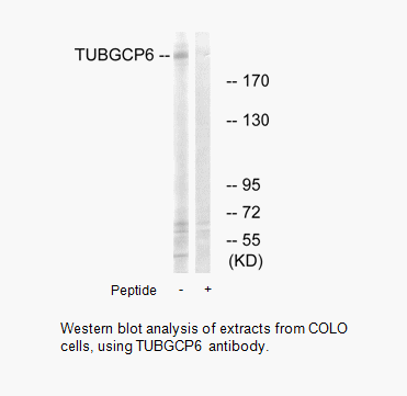 Product image for TUBGCP6 Antibody