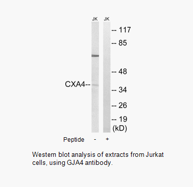 Product image for GJA4 Antibody